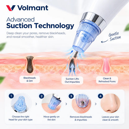 Blackhead Suction Cleaner – Pore Vacuum with 5 Suction Levels