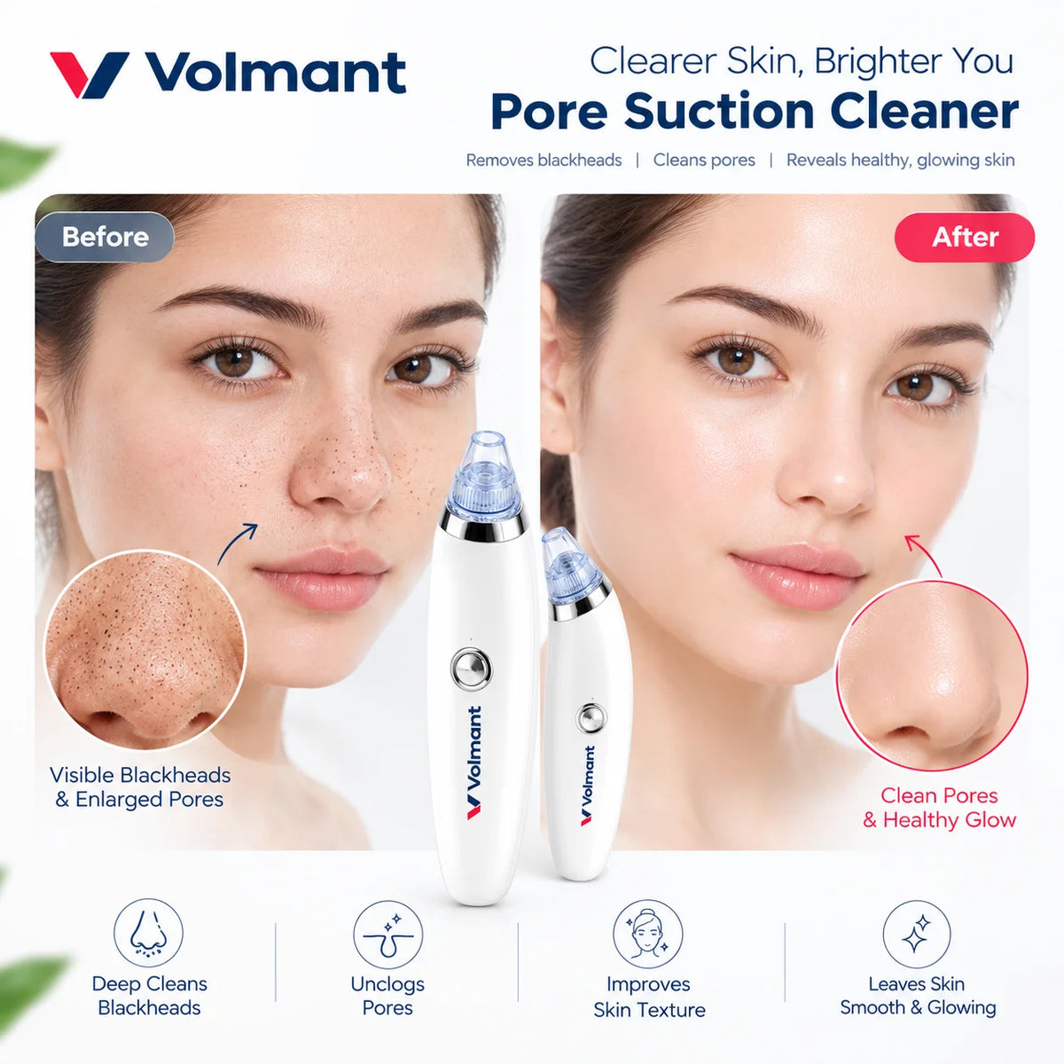 Blackhead Suction Cleaner – Pore Vacuum with 5 Suction Levels