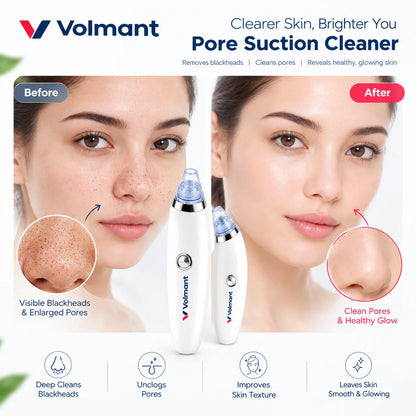 Blackhead Suction Cleaner – Pore Vacuum with 5 Suction Levels