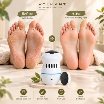 Electric Callus Remover – USB Rechargeable Foot File Tool